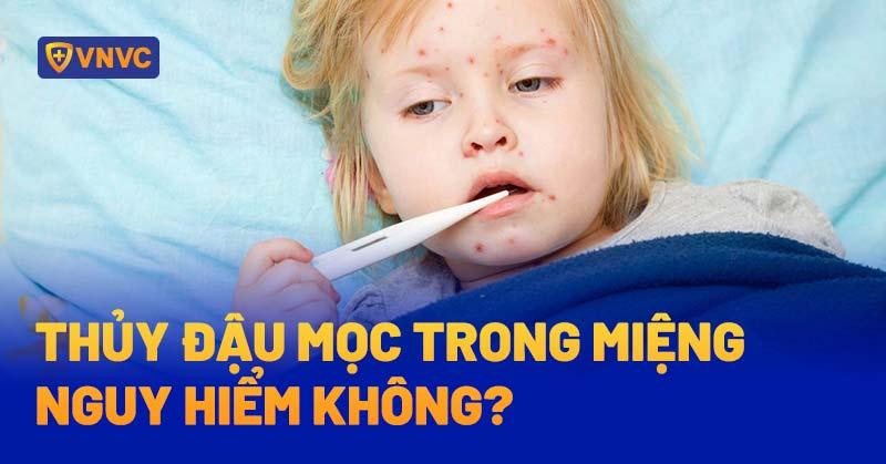 thủy đậu mọc trong miệng