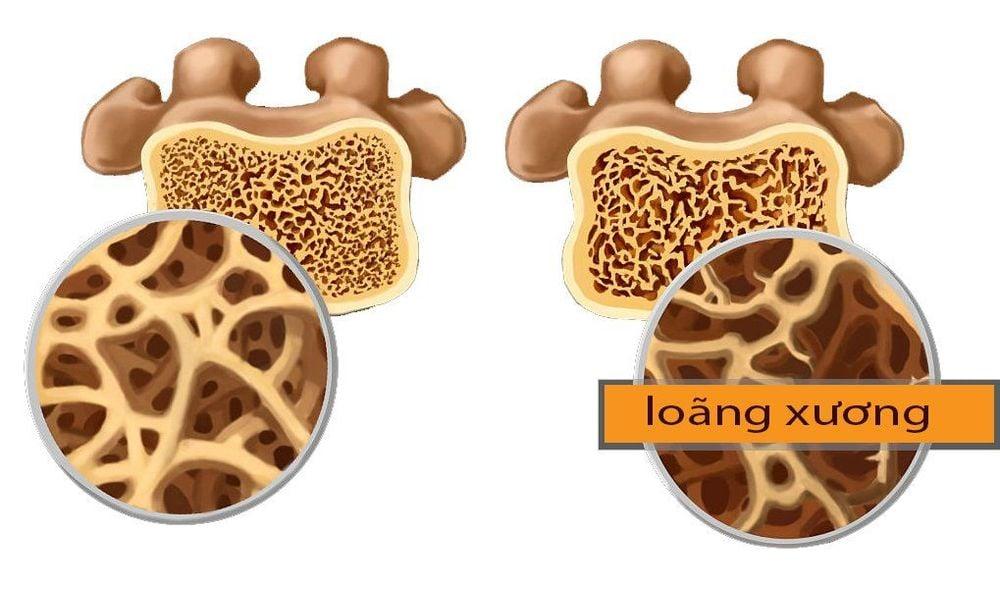 Vitamin D3 có tác dụng gì?