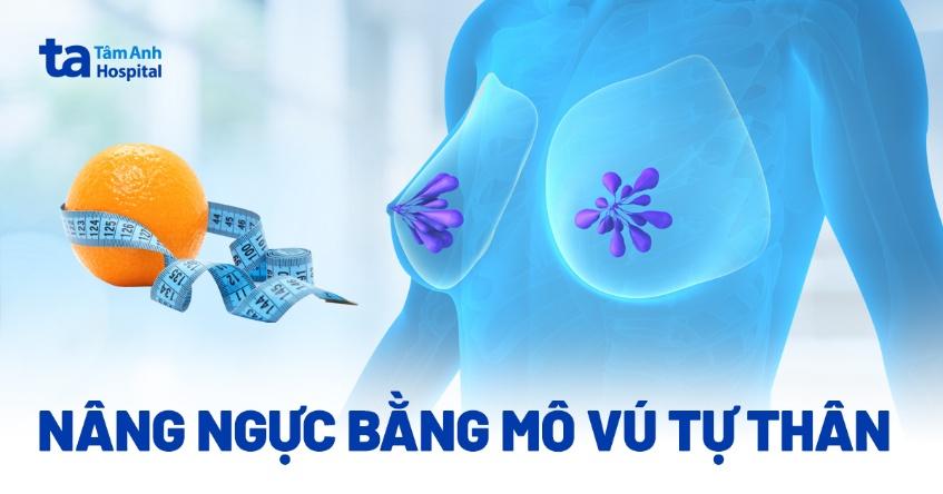 nâng ngực bằng mô vú tự thân