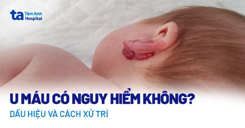 u máu có nguy hiểm không