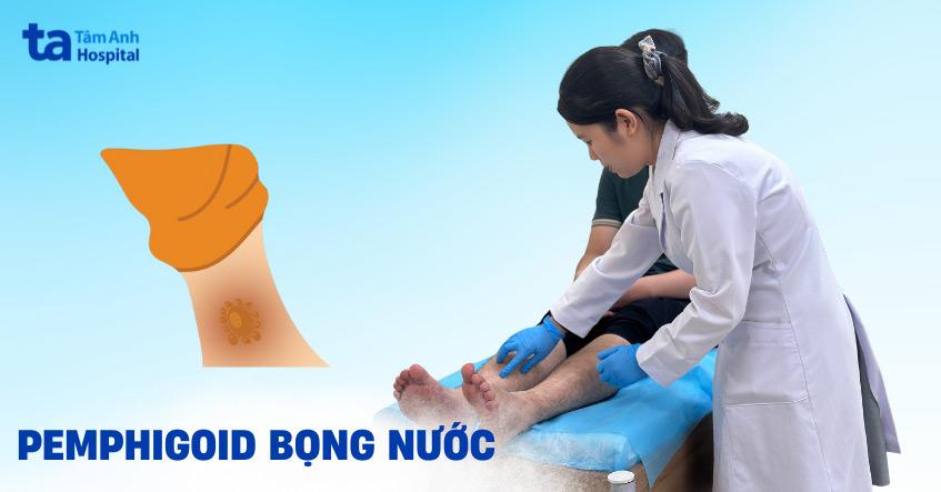 pemphigoid bọng nước